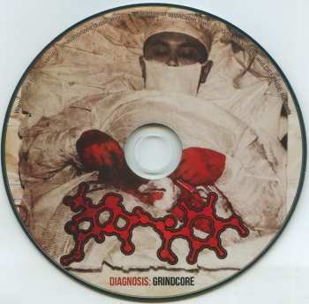 CD Amoclen: Diagnosis: Grindcore 241715