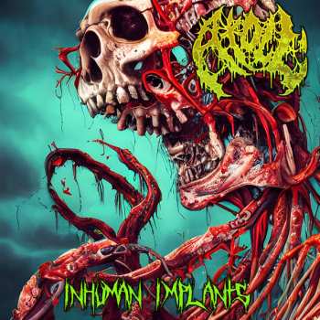 Album Atoll: Inhuman Implants