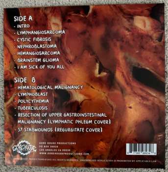 LP Blasted Pancreas: Carcinoma CLR | LTD 608528