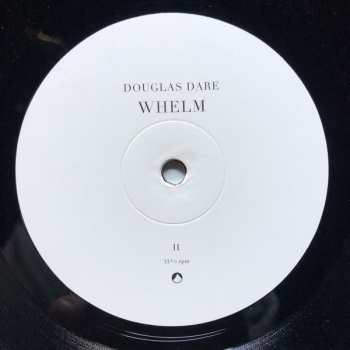 LP Douglas Dare: Whelm LTD 72658