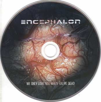 2CD Encephalon: We Only Love You When You're Dead DLX 275459