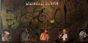 LP Haemorrhage: Anatomical Inferno CLR | LTD 620971