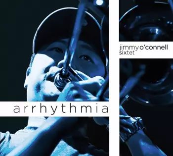 Arrhythmia