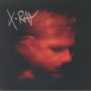 Album Murdock: X-Ray