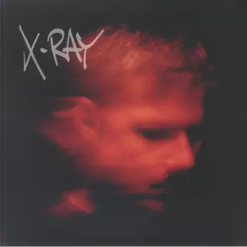 X-Ray