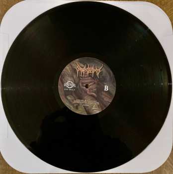 LP Sepsism: Purulent Decomposition 585241