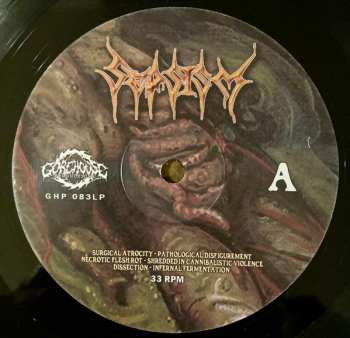 LP Sepsism: Purulent Decomposition 585241