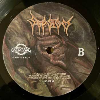 LP Sepsism: Purulent Decomposition 585241