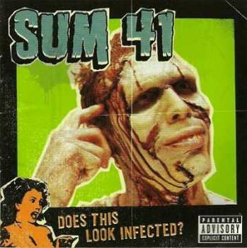 LP Sum 41: Does This Look Infected? LTD 569358