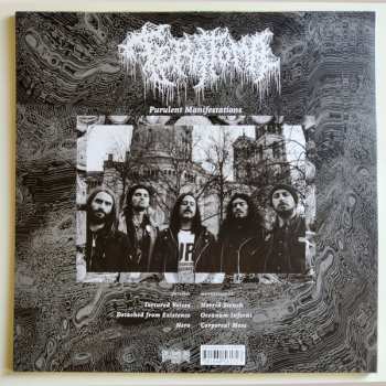 LP Teratoma: Purulent Manifestations 566238