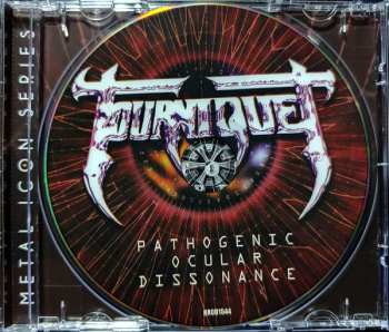 CD Tourniquet: Pathogenic Ocular Dissonance 591901