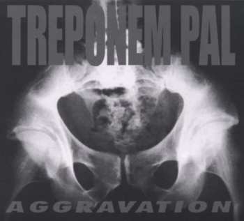 CD Treponem Pal: Aggravation LTD | NUM | DIGI 413761